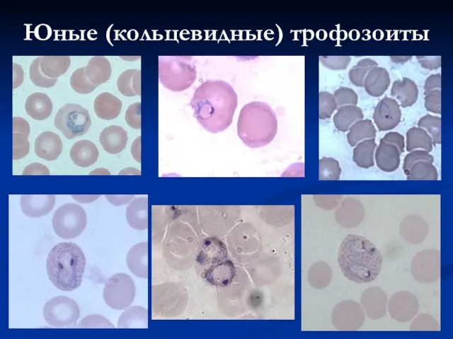 Юные (кольцевидные) трофозоиты