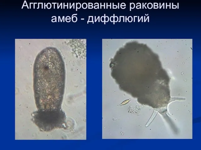 Агглютинированные раковины амеб - диффлюгий