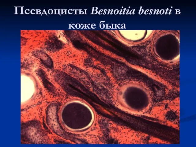 Псевдоцисты Besnoitia besnoti в коже быка