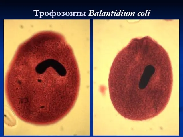 Трофозоиты Balantidium coli