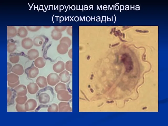 Ундулирующая мембрана (трихомонады)