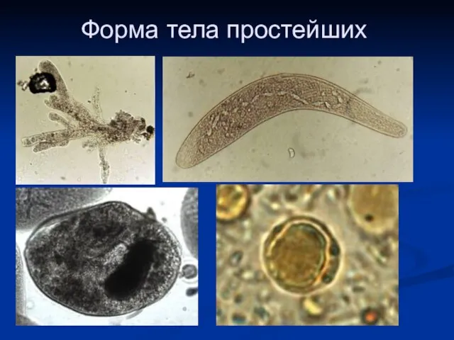 Форма тела простейших