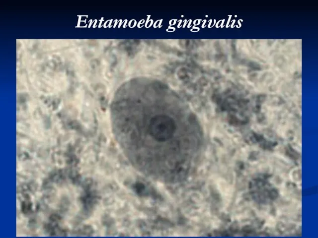 Entamoeba gingivalis