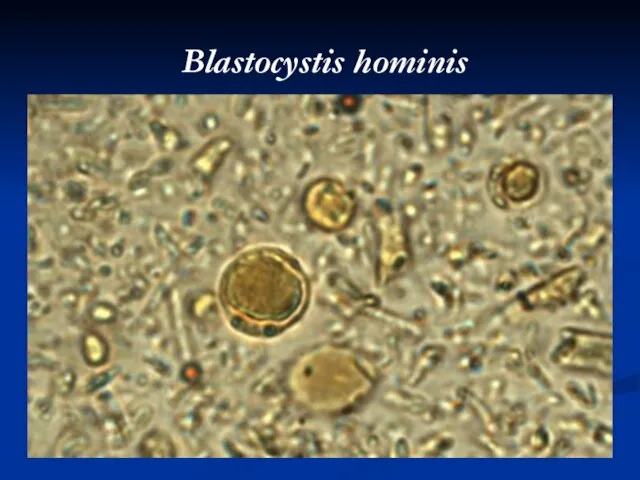 Blastocystis hominis