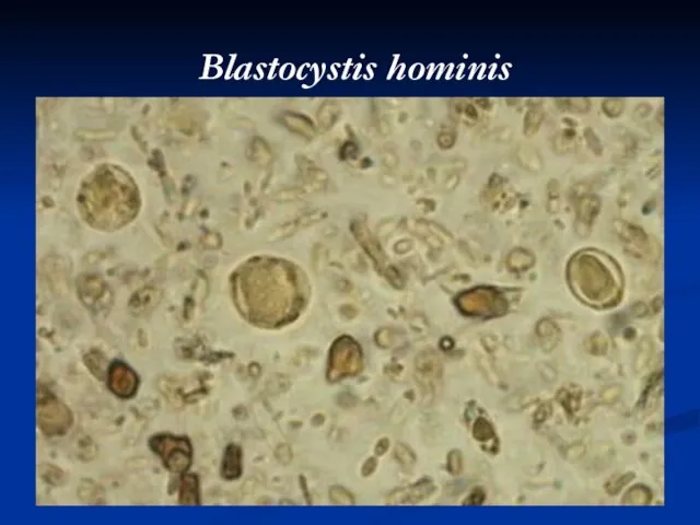 Blastocystis hominis