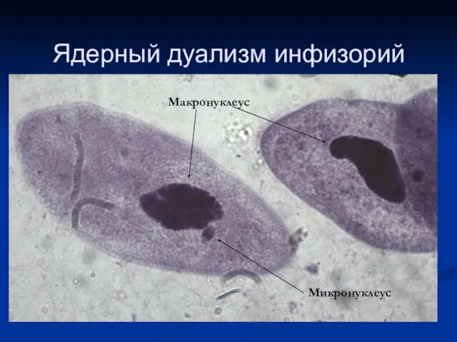 Ядерный дуализм инфизорий Макронуклеус Микронуклеус