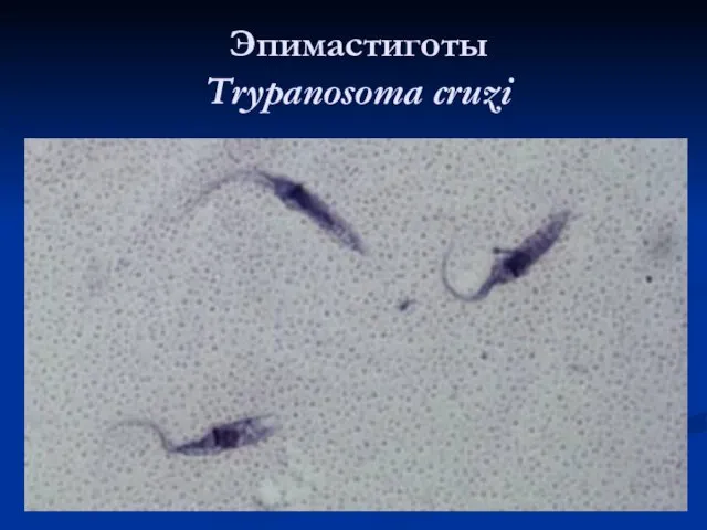 Эпимастиготы Тrypanosoma cruzi