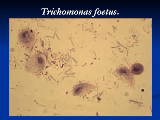 Trichomonas foetus.