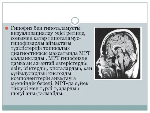 Гипофиз бен гипоталамусты визуализациялау әдісі ретінде, сонымен қатар гипоталамус-гипофизарлы аймақтағы түзілістердің