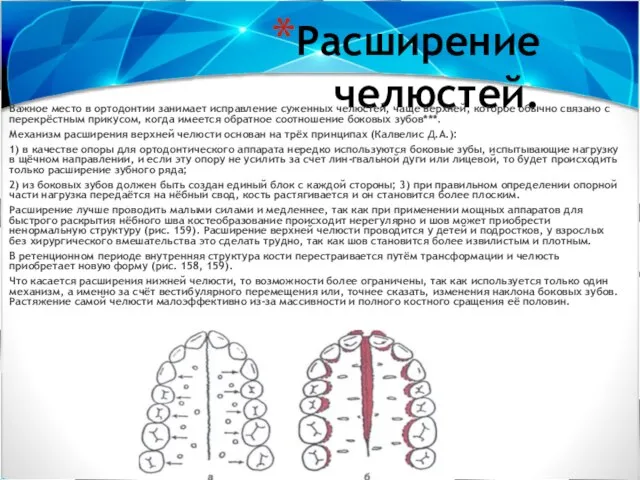 Расширение челюстей. Важное место в ортодонтии занимает исправление суженных че­люстей, чаще