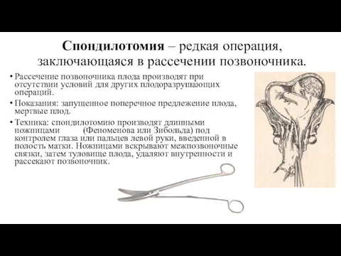 Спондилотомия – редкая операция, заключающаяся в рассечении позвоночника. Рассечение позвоночника плода