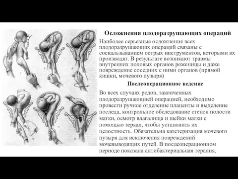 Осложнения плодоразрушающих операций Наиболее серьезные осложнения всех плодоразрушающих операций связаны с