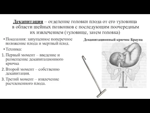 Декапитация – отделение головки плода от его туловища в области шейных