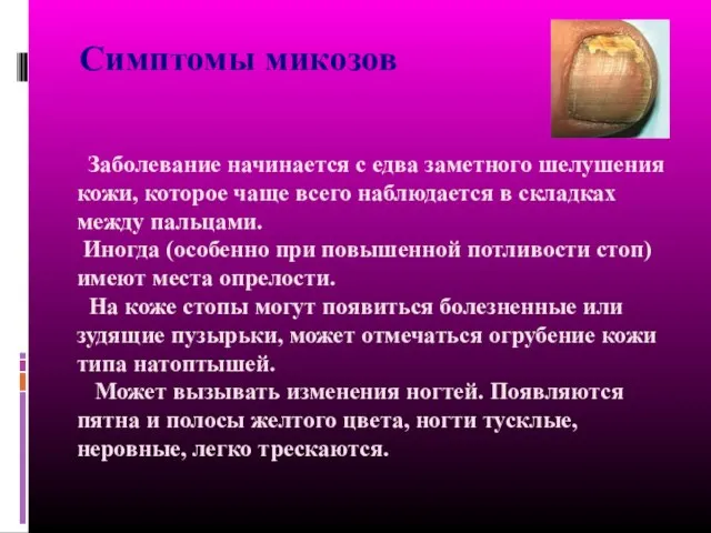 Заболевание начинается с едва заметного шелушения кожи, которое чаще всего наблюдается