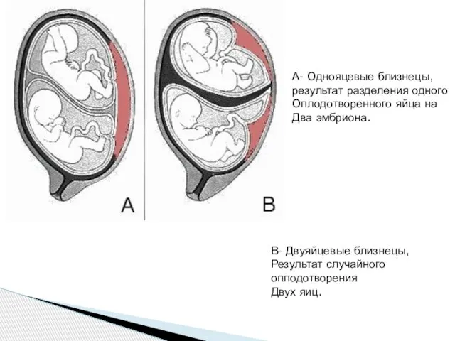 А- Однояцевые близнецы, результат разделения одного Оплодотворенного яйца на Два эмбриона.