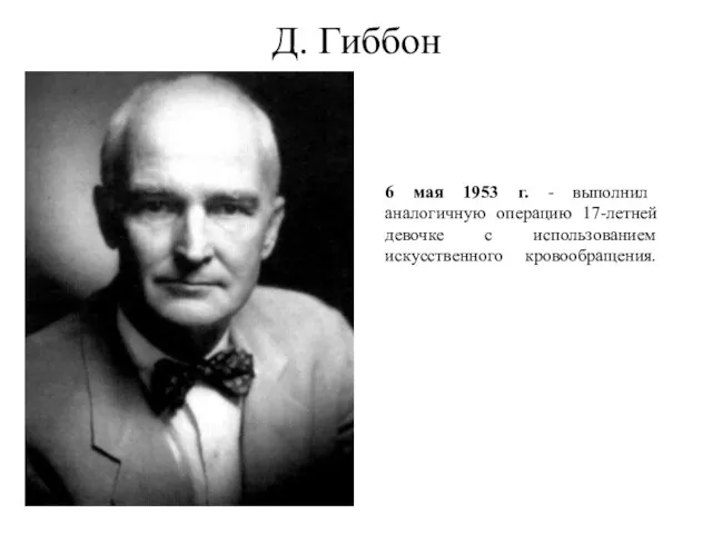 Д. Гиббон 6 мая 1953 г. - выполнил аналогичную операцию 17-летней девочке с использованием искусственного кровообращения.