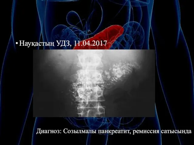 Науқастың УДЗ, 11.04.2017 Диагноз: Созылмалы панкреатит, ремиссия сатысында