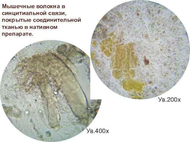 Мышечные волокна в синцитиальной связи, покрытые соединительной тканью в нативном препарате. Ув.400х Ув.200х