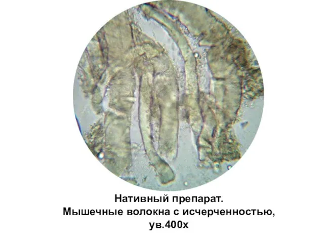 Нативный препарат. Мышечные волокна с исчерченностью, ув.400х