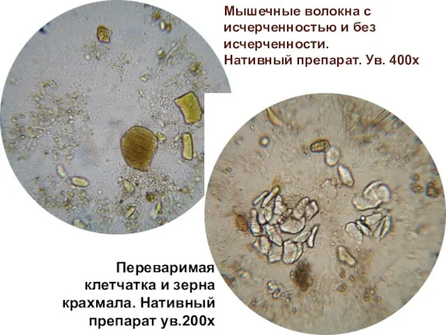 Мышечные волокна с исчерченностью и без исчерченности. Нативный препарат. Ув. 400х