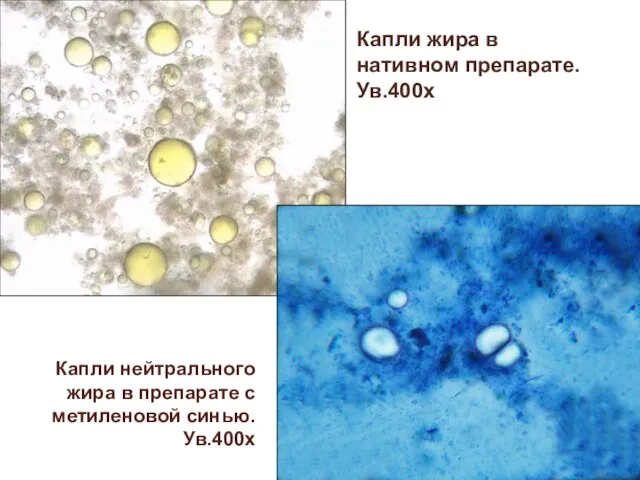 Капли нейтрального жира в препарате с метиленовой синью. Ув.400х Капли жира в нативном препарате. Ув.400х