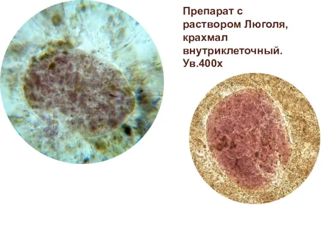 Препарат с раствором Люголя, крахмал внутриклеточный. Ув.400х