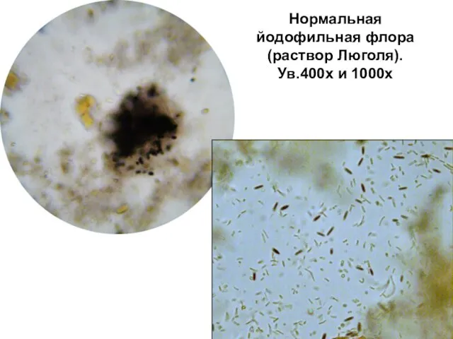 Нормальная йодофильная флора (раствор Люголя). Ув.400х и 1000х