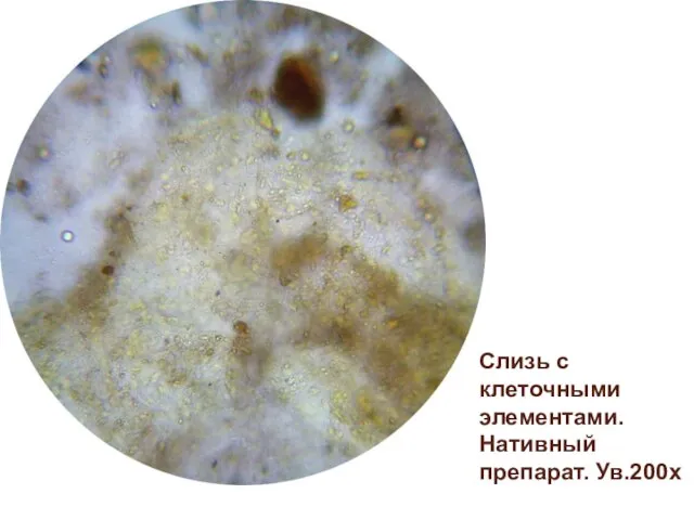 Слизь с клеточными элементами. Нативный препарат. Ув.200х