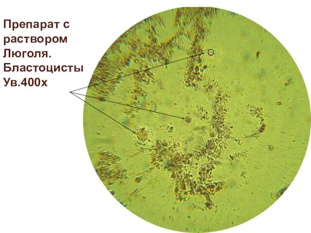 Препарат с раствором Люголя. БластоцистыУв.400х