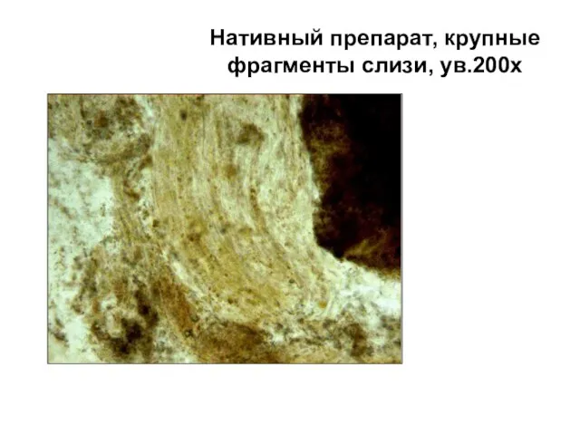 Нативный препарат, крупные фрагменты слизи, ув.200х