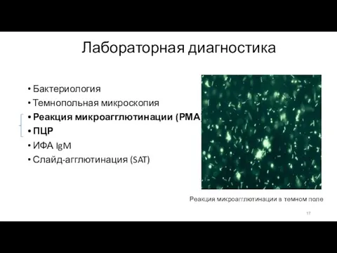 Лабораторная диагностика Бактериология Темнопольная микроскопия Реакция микроагглютинации (РМА) ПЦР ИФА IgM