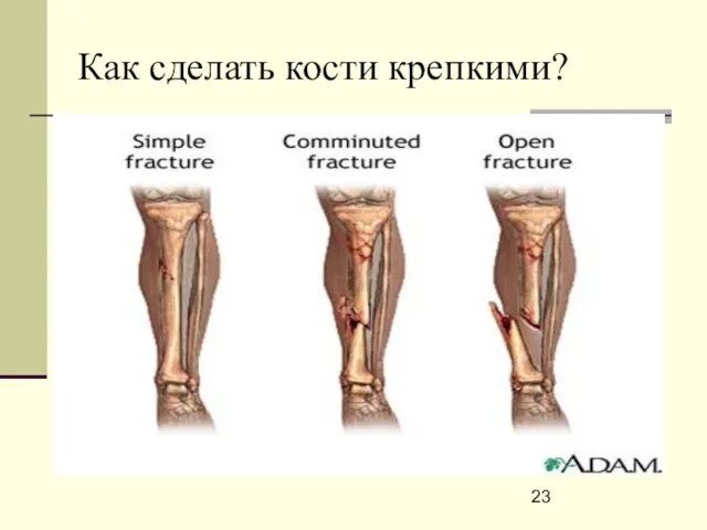 Как сделать кости крепкими?