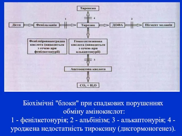 Біохімічні "блоки" при спадкових порушеннях обміну амінокислот: 1 - фенілкетонурія; 2