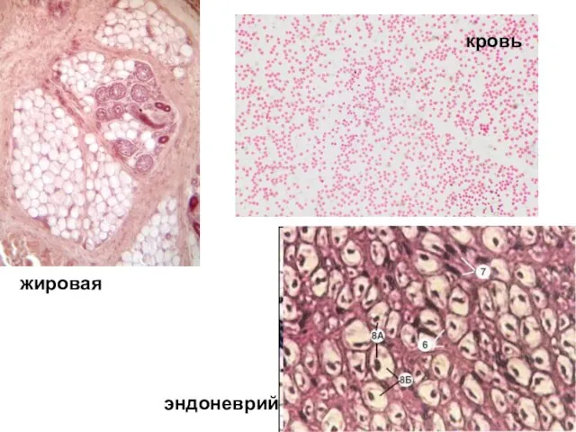 жировая кровь эндоневрий