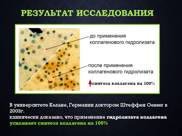 В университете Кельне, Германии доктором Штеффен Oesser в 2003г. клинически доказано,