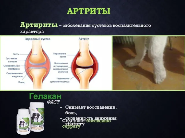 АРТРИТЫ ФАСТ Гелакан Снимает восспаление,боль, скованность движения храмоту Содержит боссвелию серрату