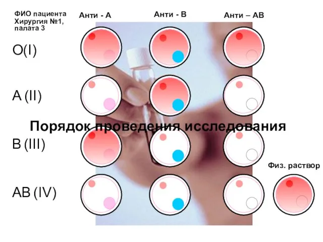 Анти - В Анти - А Анти – АВ O(I) A