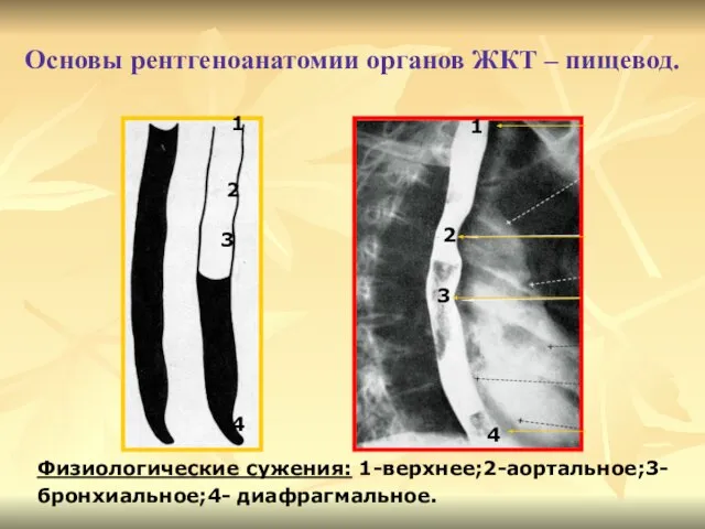 Основы рентгеноанатомии органов ЖКТ – пищевод. 2 3 1 4 1