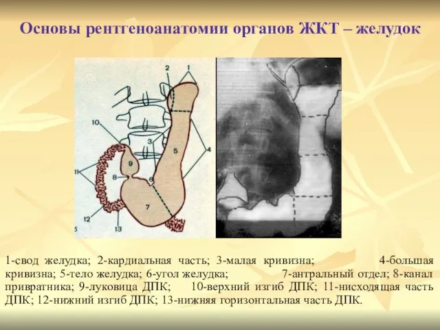 Основы рентгеноанатомии органов ЖКТ – желудок 1-свод желудка; 2-кардиальная часть; 3-малая