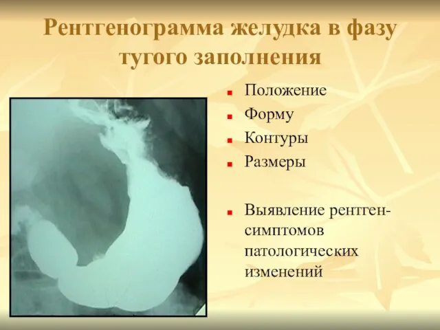 Рентгенограмма желудка в фазу тугого заполнения Положение Форму Контуры Размеры Выявление рентген-симптомов патологических изменений