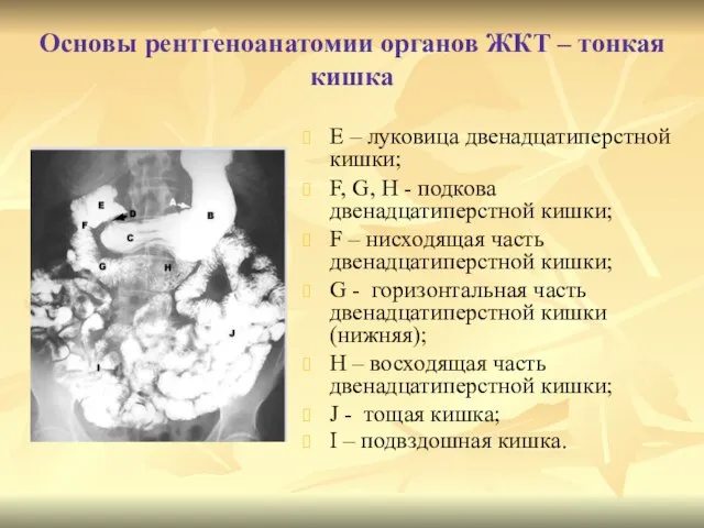 Основы рентгеноанатомии органов ЖКТ – тонкая кишка Е – луковица двенадцатиперстной