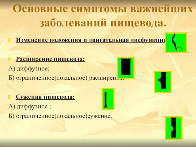 Основные симптомы важнейших заболеваний пищевода. Изменение положения и двигательная дисфункция. Расширение