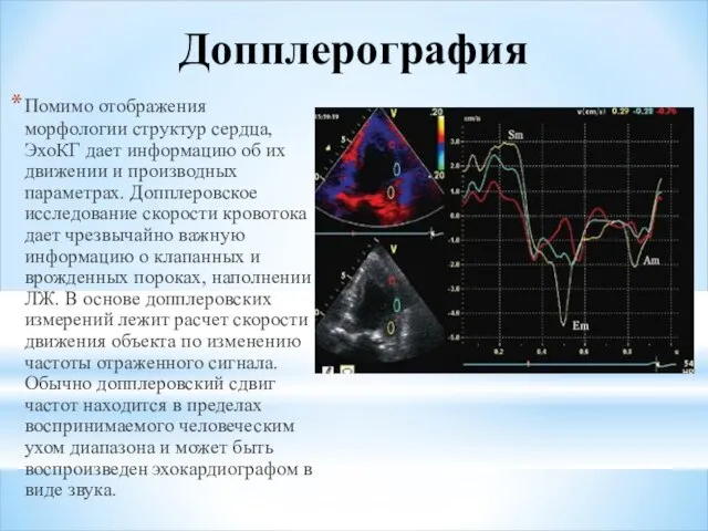 Допплерография Помимо отображения морфологии структур сердца, ЭхоКГ дает информацию об их