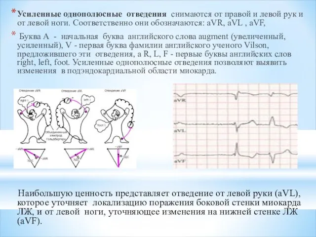 Усиленные однополюсные отведения снимаются от правой и левой рук и от