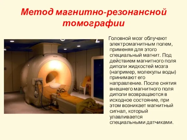 Метод магнитно-резонансной томографии Головной мозг облучают электромагнитным полем, применяя для этого