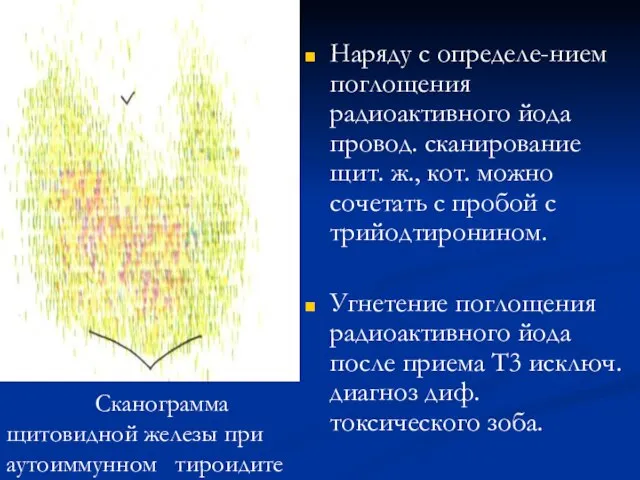 Наряду с определе-нием поглощения радиоактивного йода провод. сканирование щит. ж., кот.