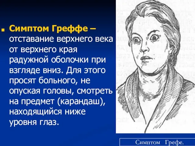 Симптом Греффе – отставание верхнего века от верхнего края радужной оболочки