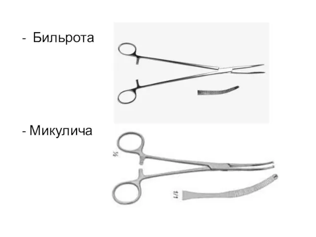 - Бильрота - Микулича