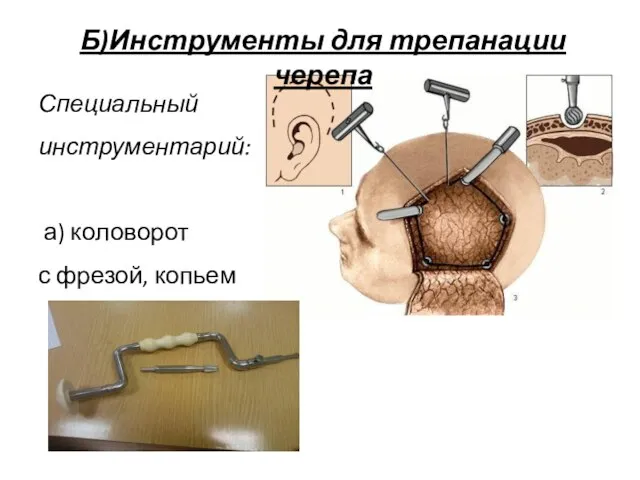 Б)Инструменты для трепанации черепа Специальный инструментарий: а) коловорот с фрезой, копьем