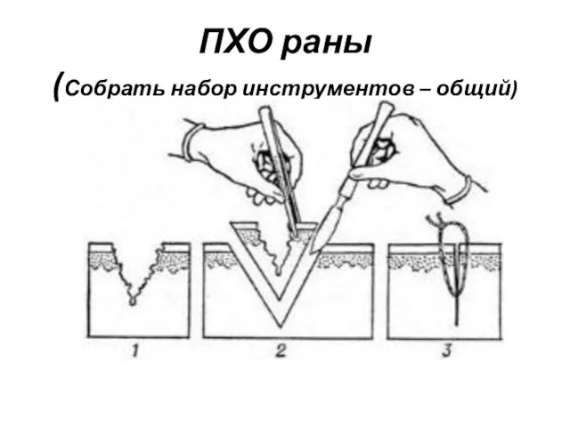 ПХО раны (Собрать набор инструментов – общий)